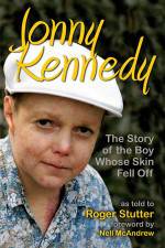 Watch The Boy Whose Skin Fell Off Putlocker