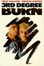 Watch Third Degree Burn Putlocker