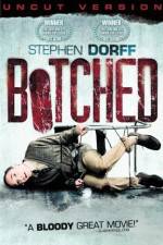 Watch Botched Putlocker
