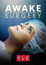 Watch Awake Surgery Putlocker