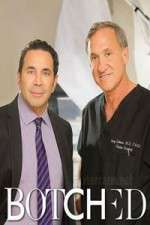 Watch Botched Putlocker